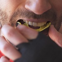 Man inserting a mouthguard