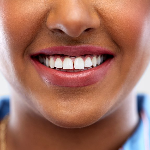 Woman with a minor gap between two teeth