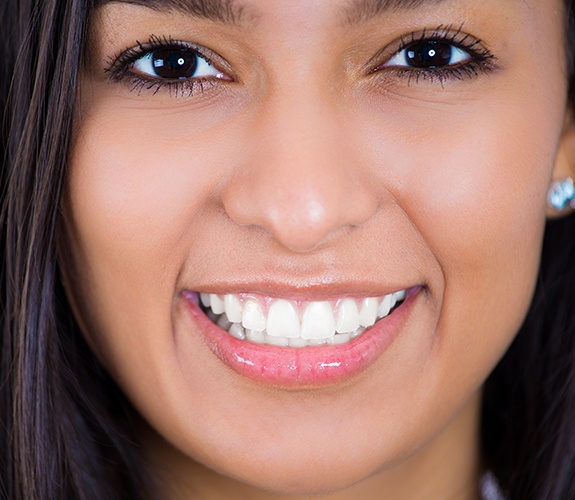 Young woman's flawless smile after teeth whitening treatment