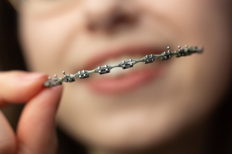 up-close view of braces after removal